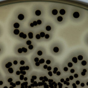 baird parker agar 金黄色葡萄球菌2